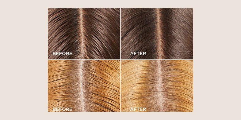 In Article Salicylic Acid For Hair 01